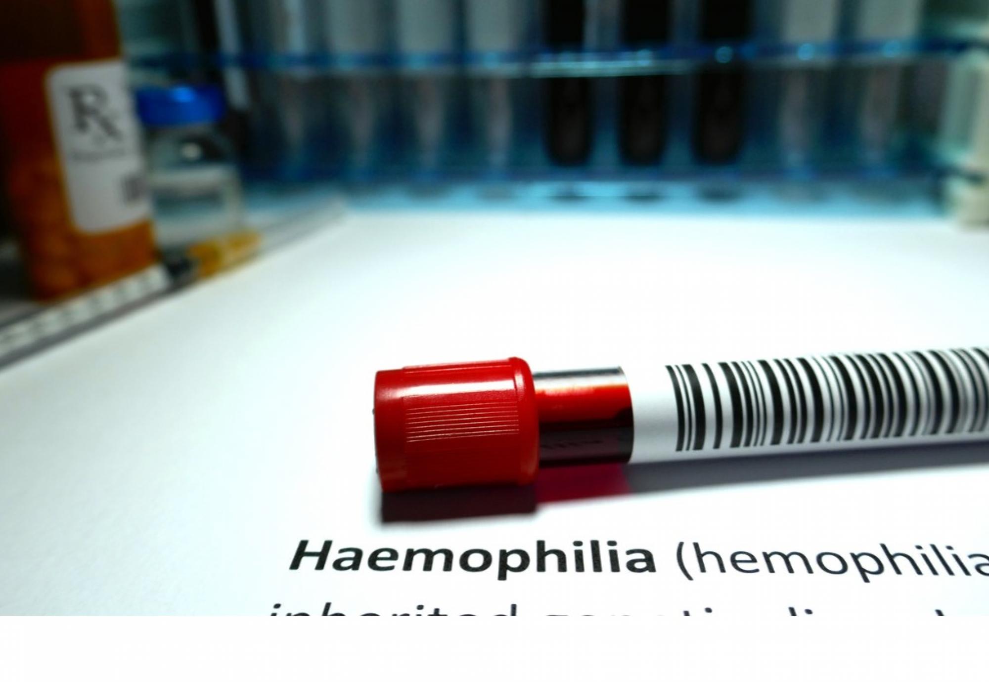 New Gene Therapy To Transform Haemophilia Patients’ Lives | UK ...