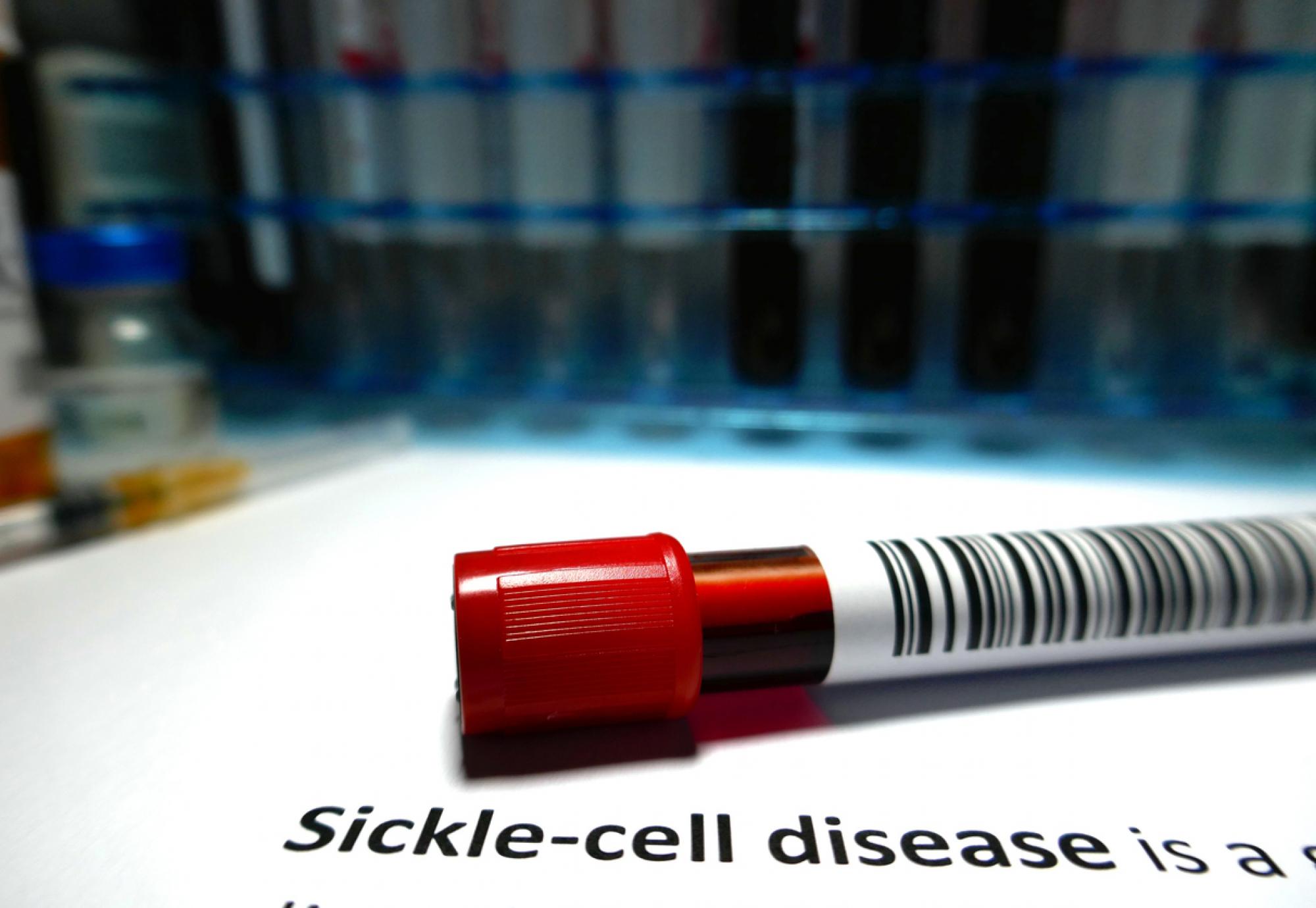 Sickle cell disease