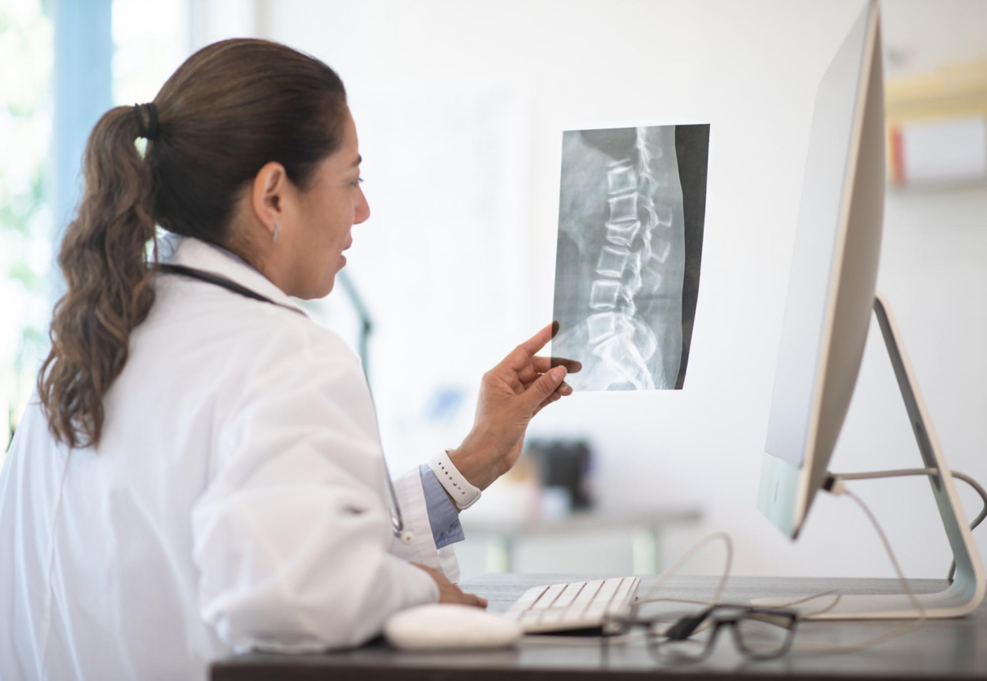 Doctor looking at an x-ray