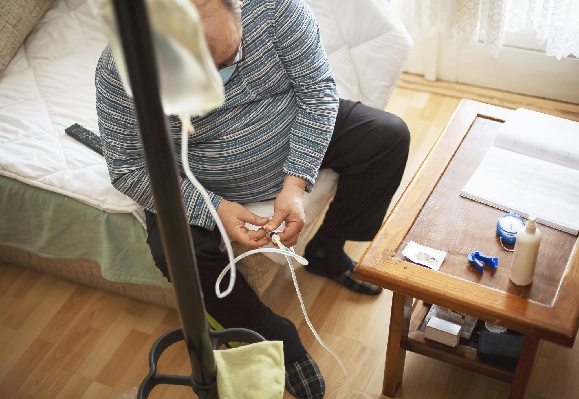 Senior man connecting peritoneal dialysis with catheter at home