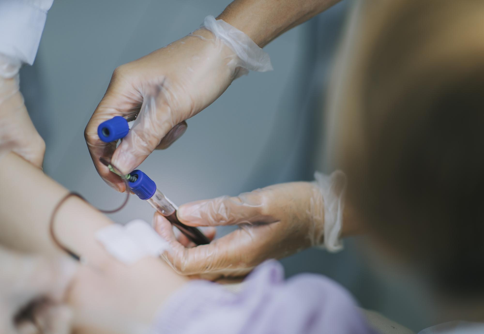 nurse drawing blood for a blood test