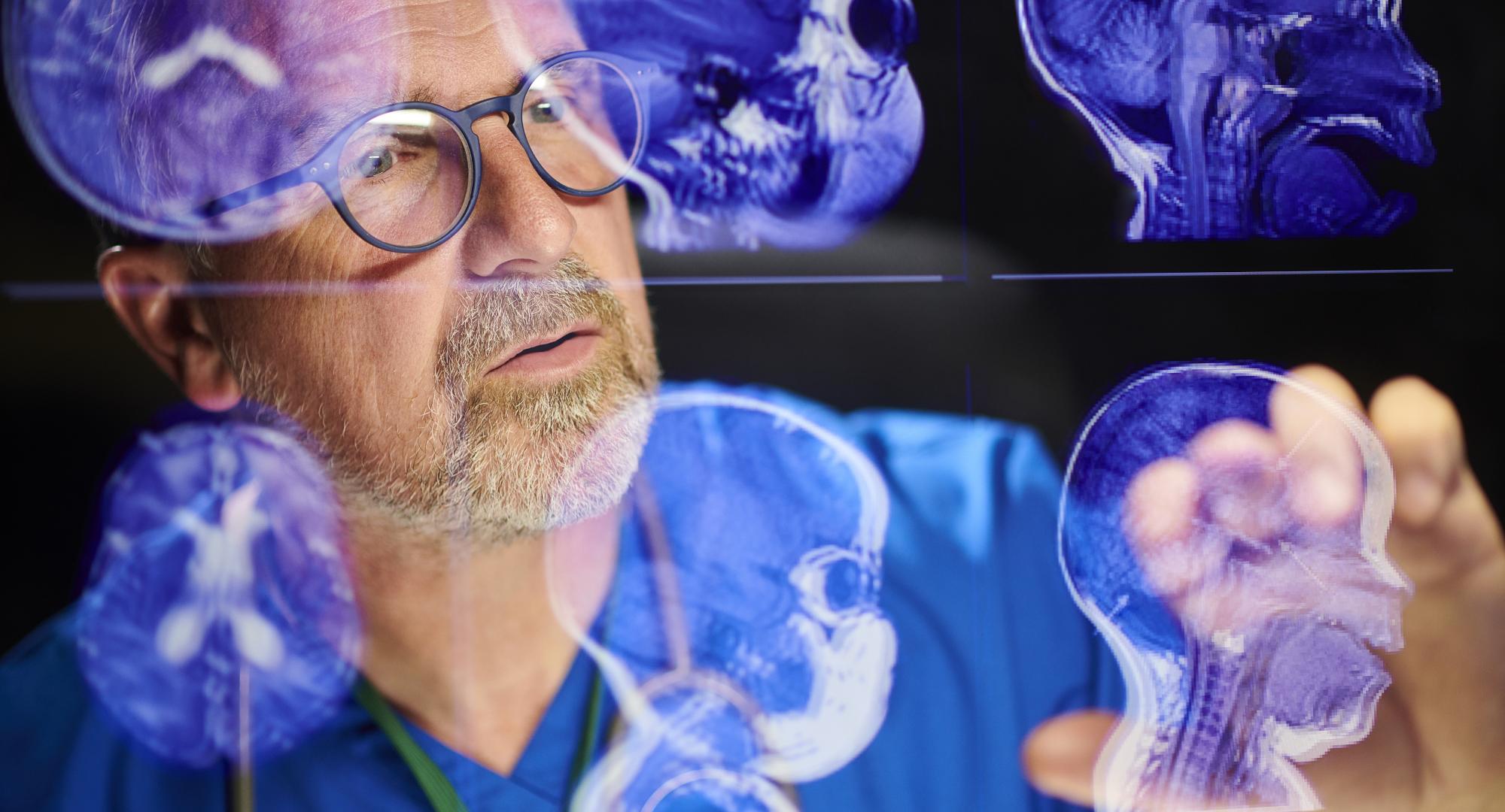 Medical professional looking at brain scans