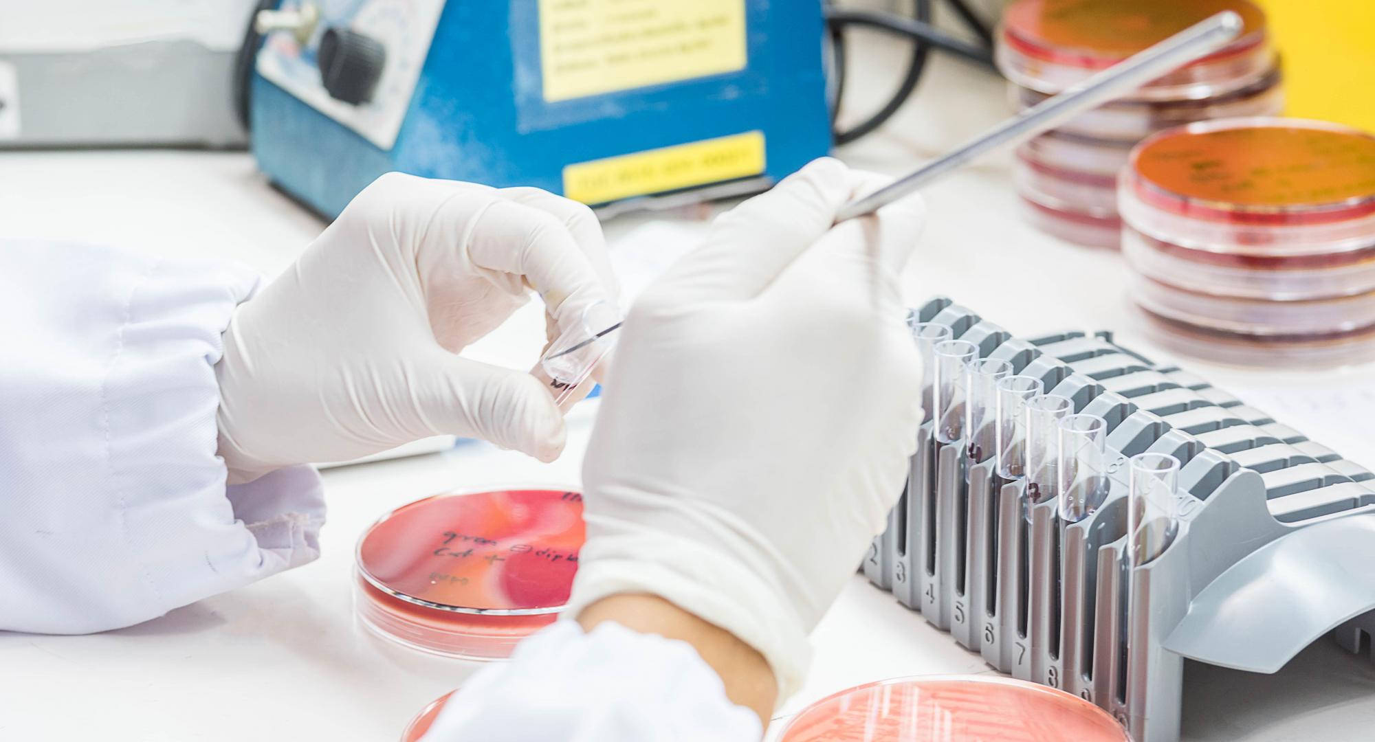 Bacteria culture
