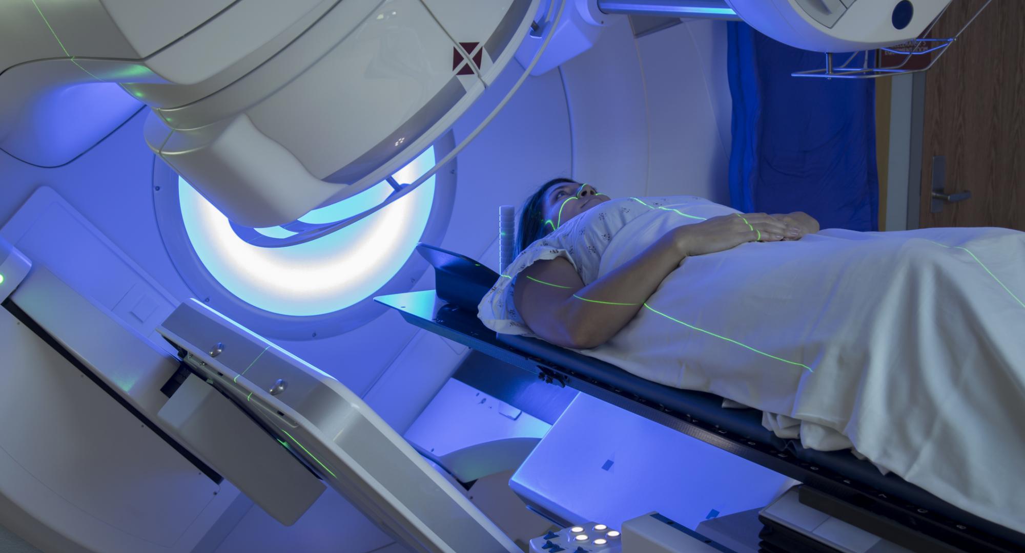 Radiotherapy breast cancer
