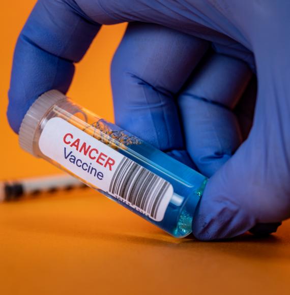 Cancer vaccine clinical trial